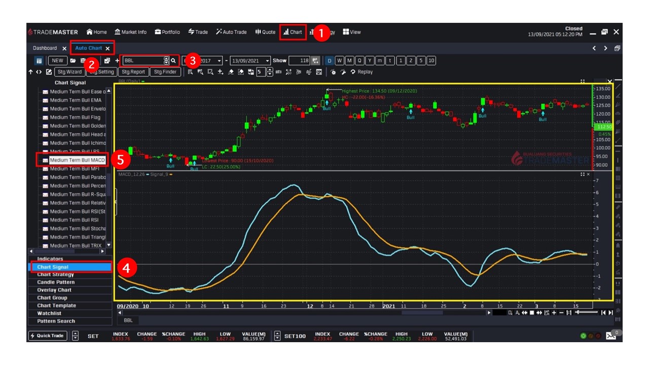 MACD คือ วิธีใช้